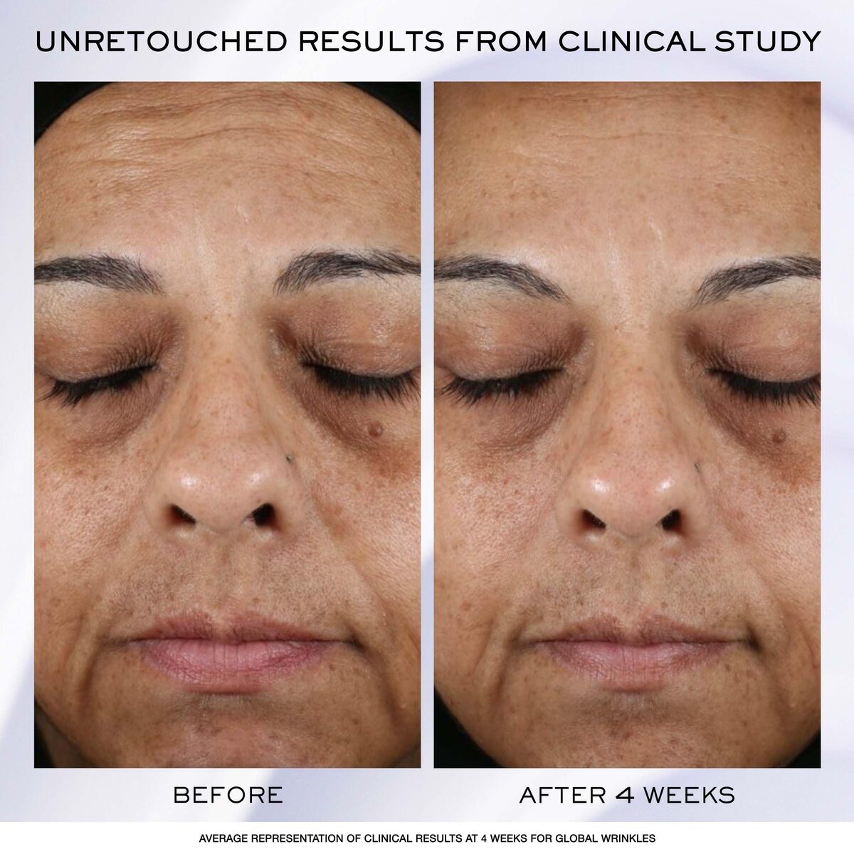 V2HCB855FB7BE53080A1EFD98754AAE6275R7815408P2